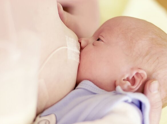 A mom breastfeeding her baby and supplementing the diet using Medela's Supplemental Nursing System™ (SNS).