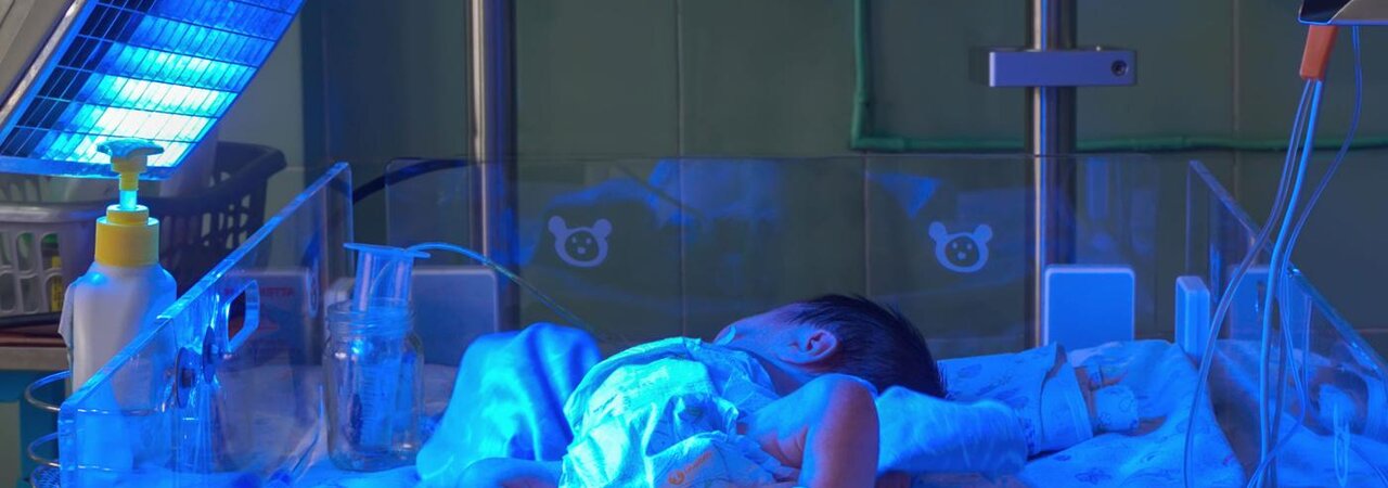 premature baby differs from a full term baby