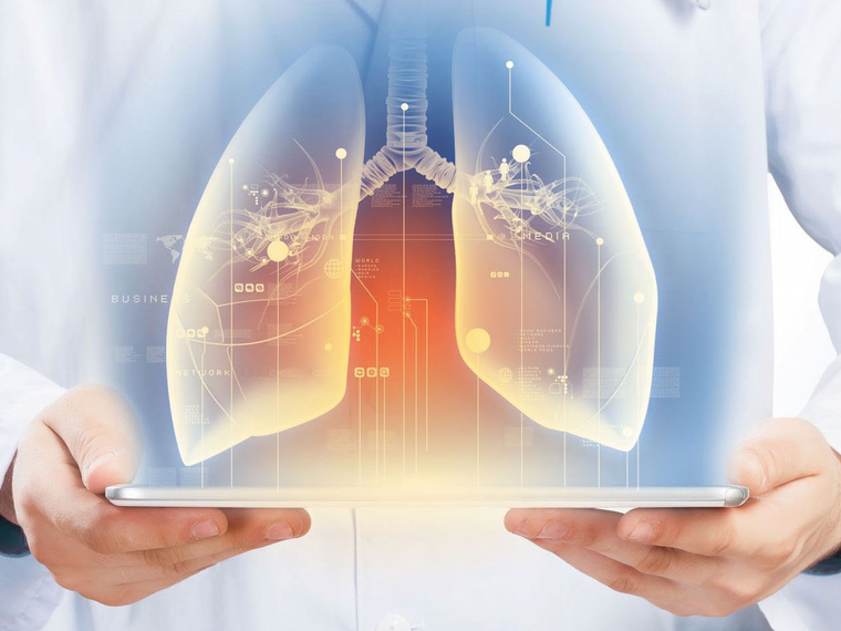 Thopaz+ digital chest drainage and monitoring system A graphic representation of the lungs on a tablet held by a healthcare professional.